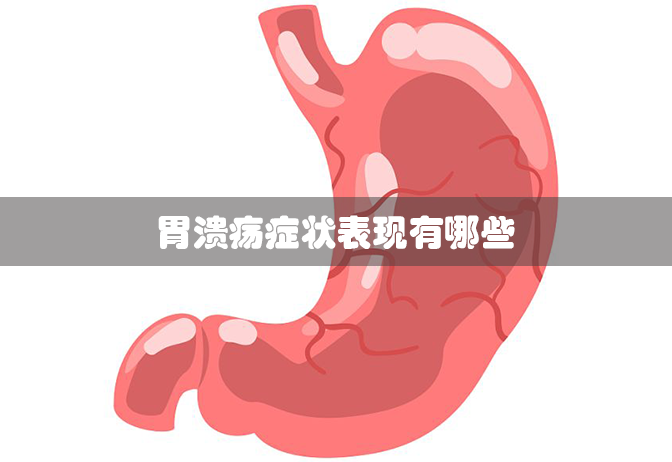 胃溃疡症状表现有哪些