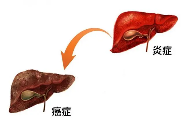 预防癌症，多吃抗炎食物