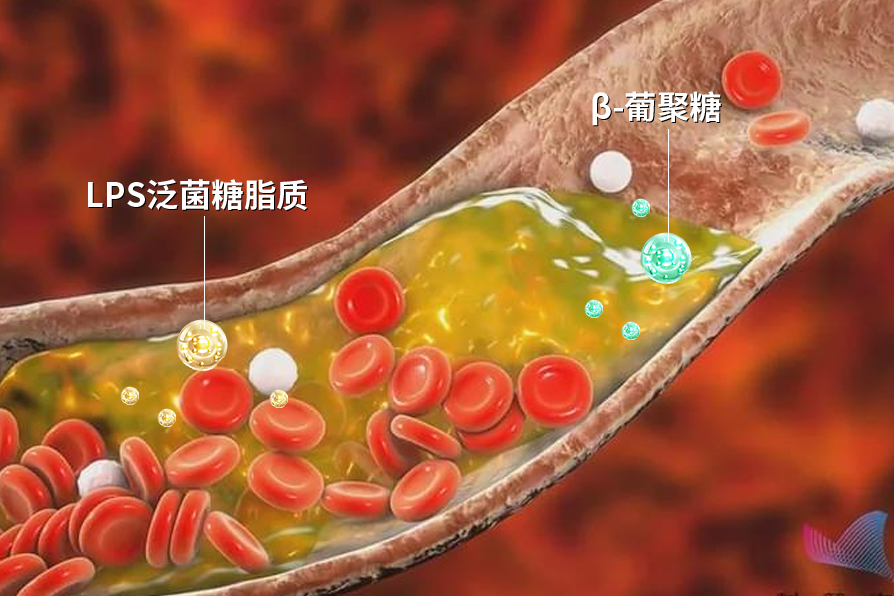 lps清除血管异物.jpg