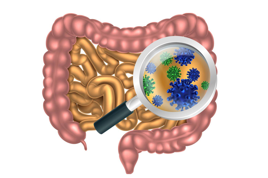 肠道不健康.jpg