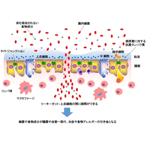 脂多糖（LPS）对肠漏症患者安全吗？